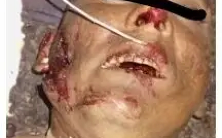 سحق هجوم لقوات(الحلو) والقوات الخاصة للمليشيا بقيادة (كولومبي) على الفاشر