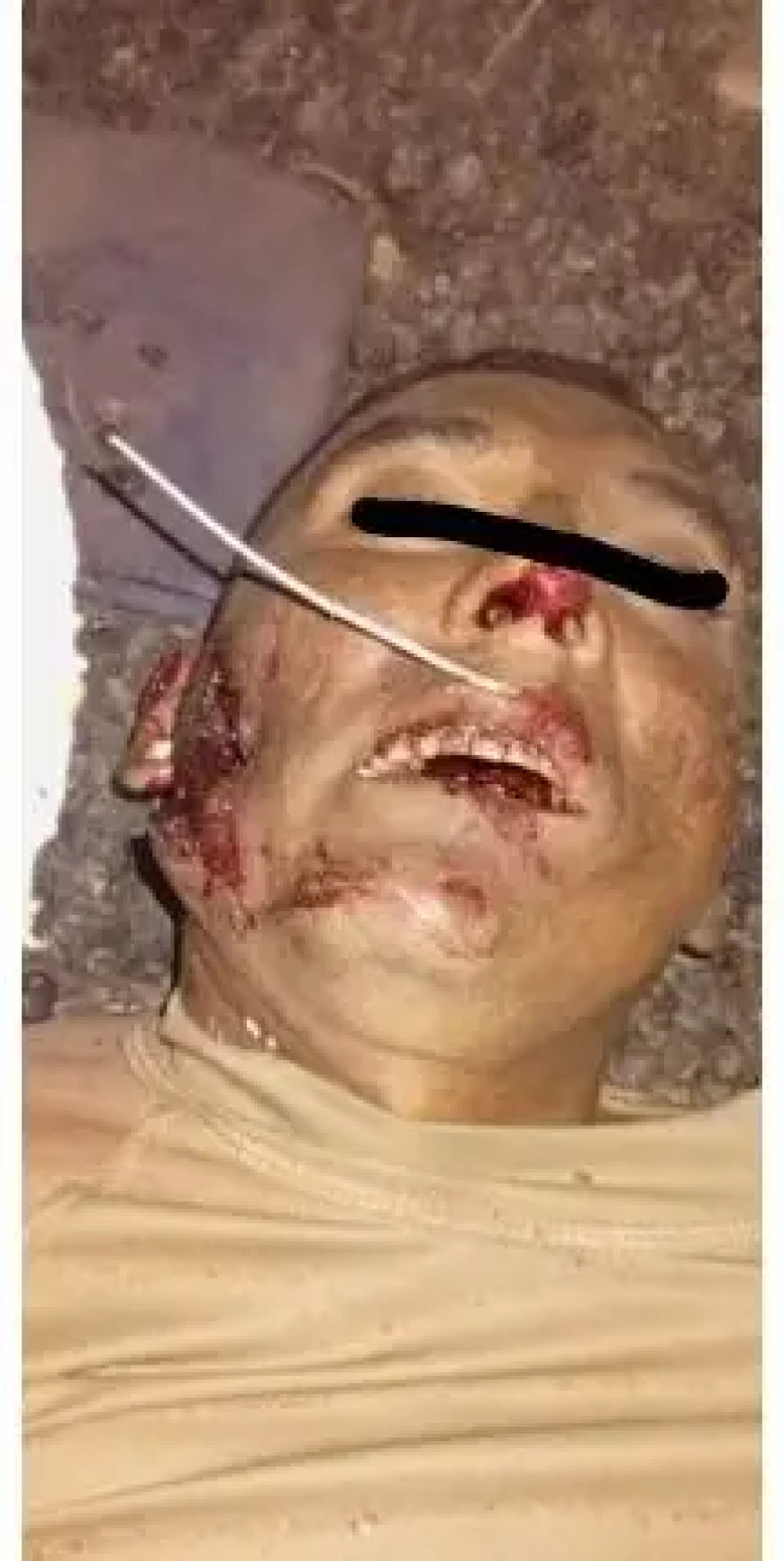 سحق هجوم لقوات(الحلو) والقوات الخاصة للمليشيا بقيادة (كولومبي) على الفاشر