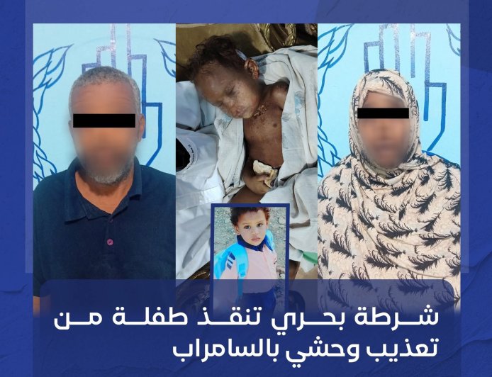 على يد خالتها وزوجها...إنقاذ طفلة من تعذيب وحشي بالسامراب