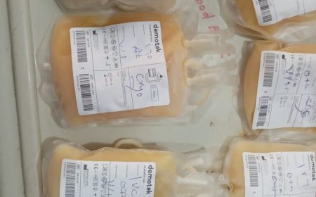 لأول مرة... بنك الدم المركزي بمدني يوفر مشتق (الكرايوبريسبيتات) مجاناً   