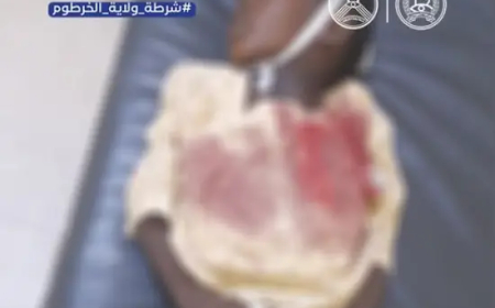فاجعة.. رصاصة طائشة تنهي حياة طفل في العاصمة 